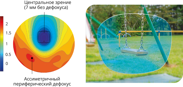 Центральная зрения зона и асимметричный периферический дефокус